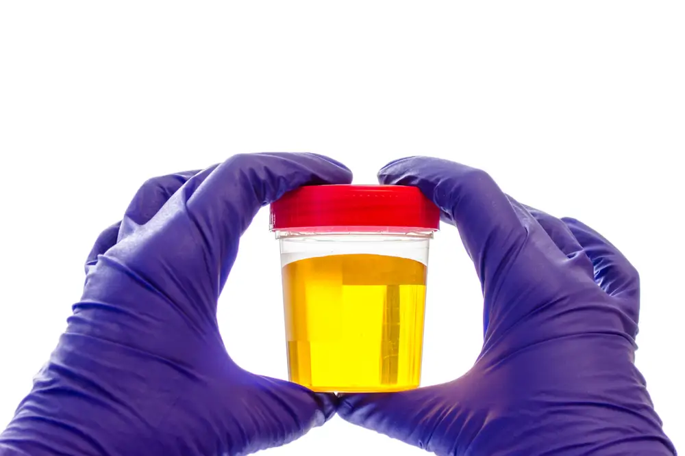 urine test for methadone